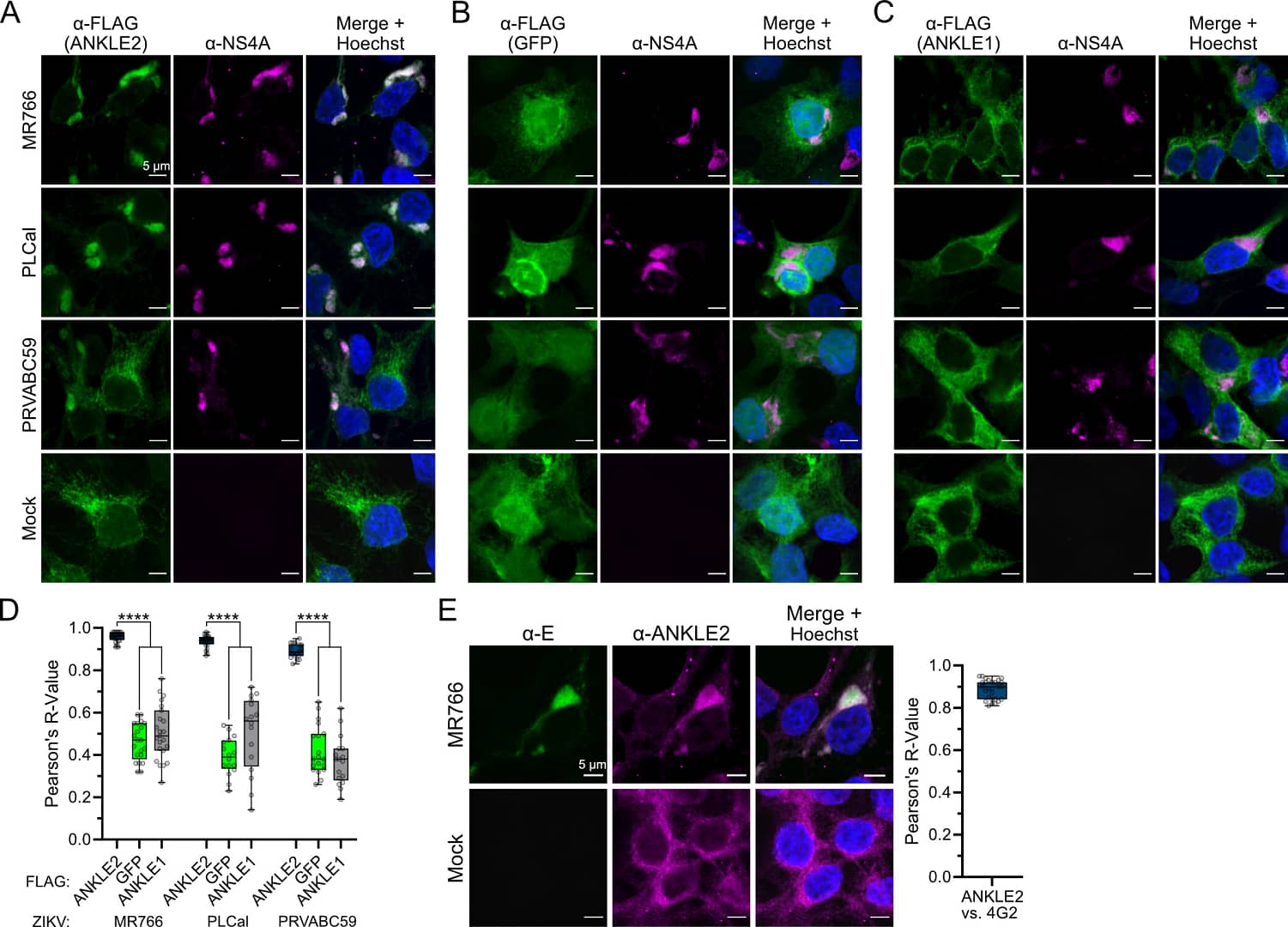 Рис. 1. ANKLE2 локализуется совместно с белками ZIKV во время инфекции.